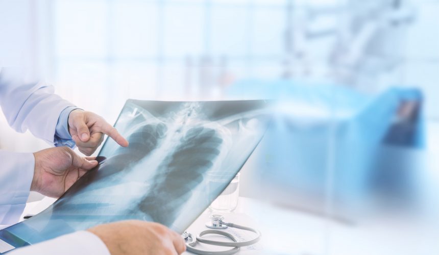 Lung Cancer treatment/ MyUSADr. Second Medical Opinion/ Virtual Doctor